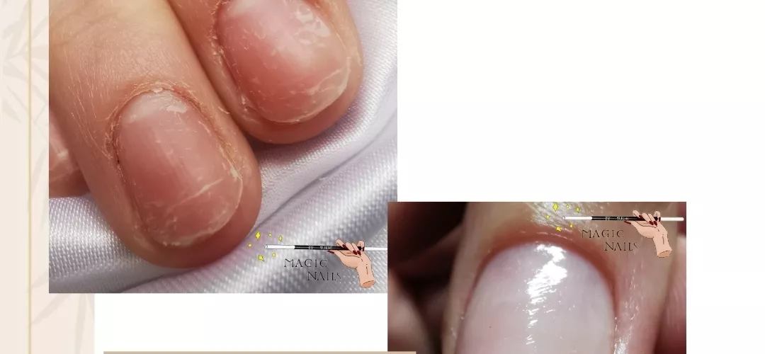 Est-ce que mes ongles respirent ?